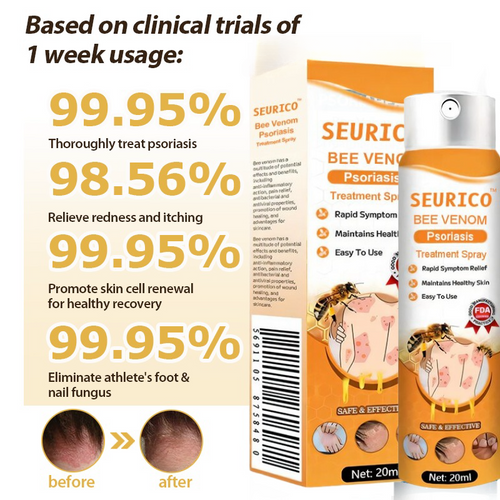 Seurico™ Bee Venom Psoriasis Treatment Spray  🔥 Limited-time offer 60% 🔥