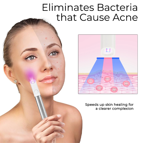 Seurico™ Electric Acne Vanish Pen