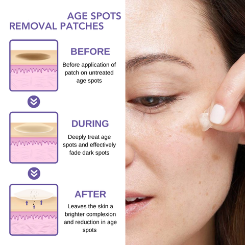 Seurico™ Age Spots Removal Patches