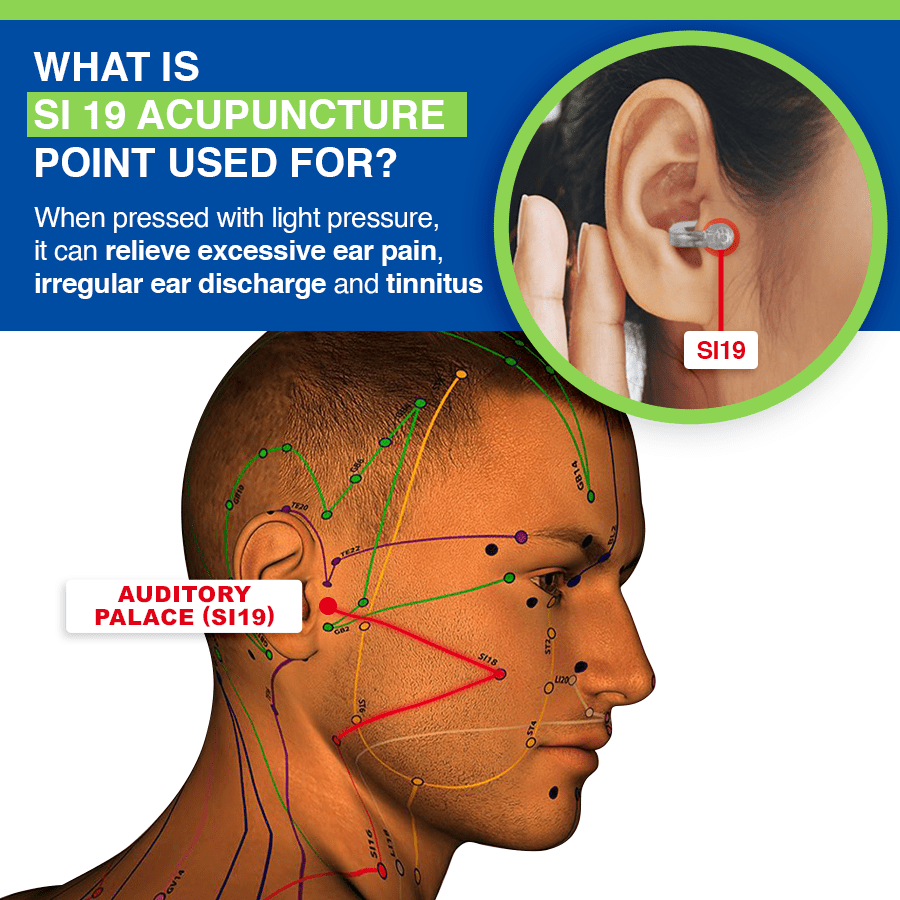 Seurico™  AcuPeace Tinnitus Relief Device 🙌